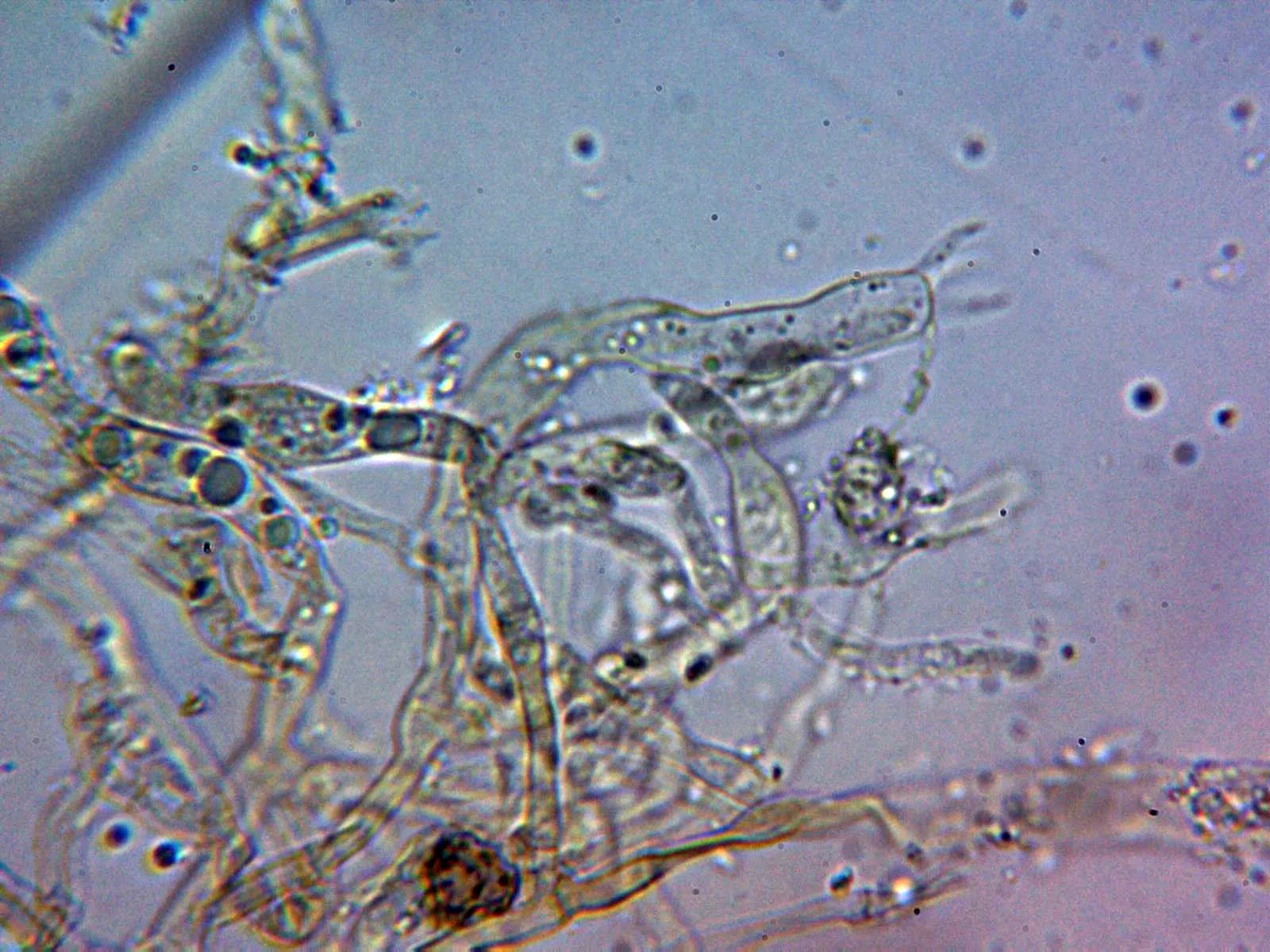 Microscopía de Tomentella lateritia - 10 - Basidios KOH 2